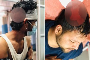 चितवनकाे कृषि क्याम्पसमा दुई विद्यार्थी संगठनबीच झडप, दुई जना गम्भीर घाइते