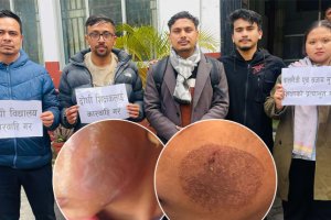 विद्यार्थीको गालामा पन्युले डाम्ने शिक्षिकालाई थप ५ दिन हिरासतमै राख्न अनुमति