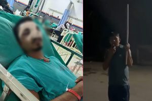 सौराहामा प्रहरी हवल्दारले दुई होटल कर्मचारीलाई कुट्दा एक गम्भीर घाइते