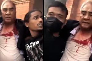 देउवा दम्पतीको अस्पतालमा उपचार हुँदै, दुवैको टाउकोमा धारिलो हतियारको प्रहार